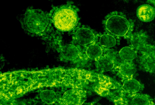 中东呼吸系统综合征冠状病毒