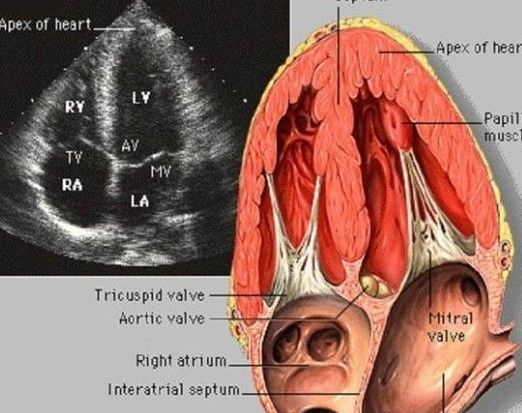 心脏彩超正常值