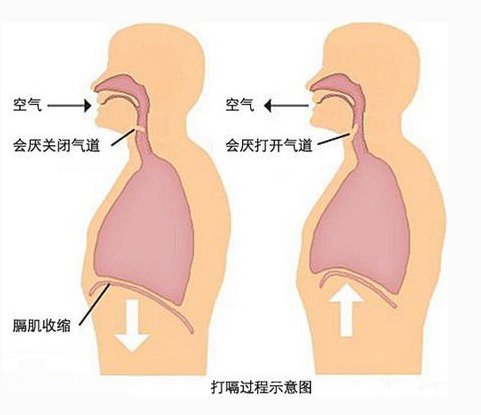 经常打嗝是什么原因？