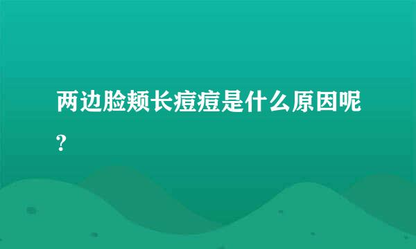 两边脸颊长痘痘是什么原因呢?