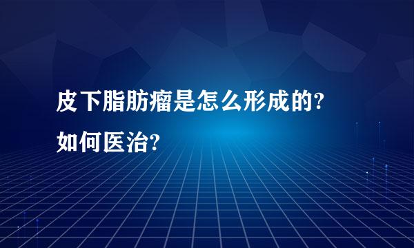 皮下脂肪瘤是怎么形成的? 如何医治?