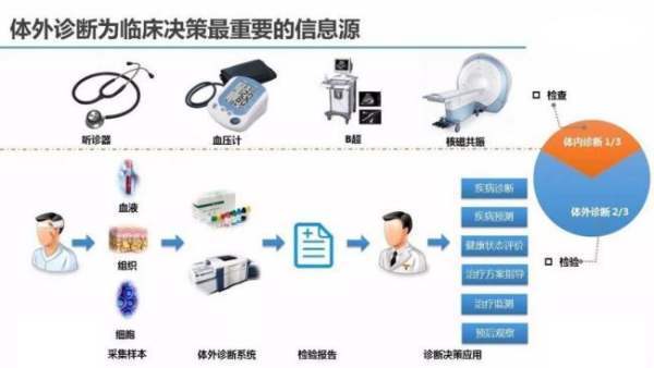 ivd是什么意思？