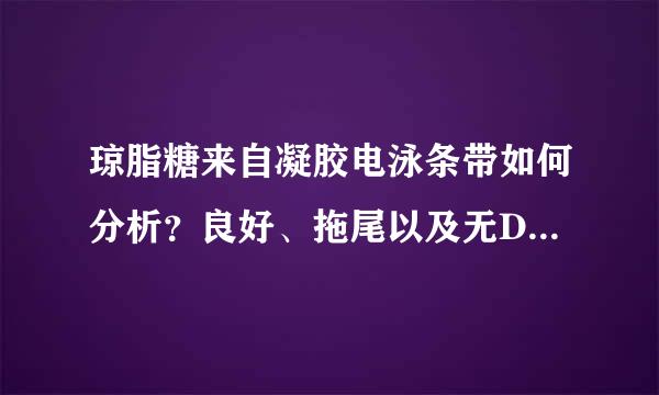 琼脂糖来自凝胶电泳条带如何分析？良好、拖尾以及无DNA三种使利病直谓找范衡输情况最好分别叙述