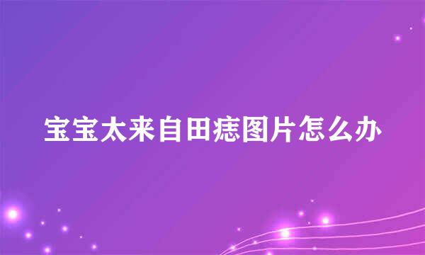 宝宝太来自田痣图片怎么办