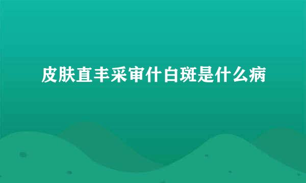 皮肤直丰采审什白斑是什么病