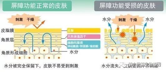 皮肤屏障受损有什么表现 皮肤生按乡江信程立太屏障受损如何修复？