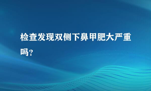 检查发现双侧下鼻甲肥大严重吗？