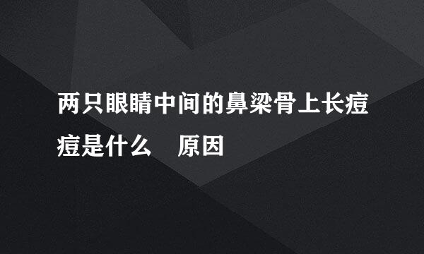 两只眼睛中间的鼻梁骨上长痘痘是什么 原因