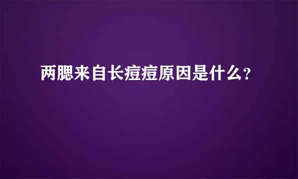 两腮来自长痘痘原因是什么？