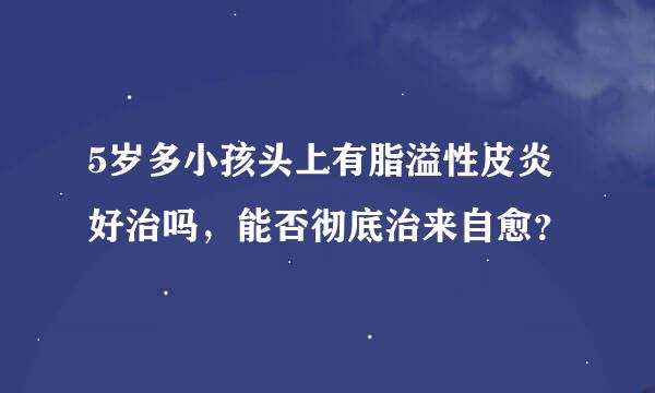 5岁多小孩头上有脂溢性皮炎好治吗，能否彻底治来自愈？