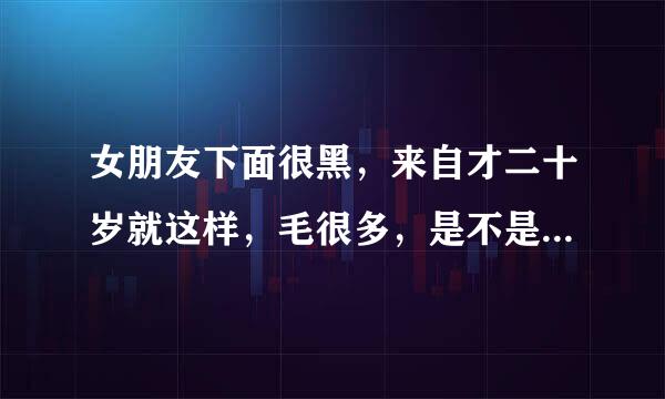 女朋友下面很黑，来自才二十岁就这样，毛很多，是不是说明她以前生活很乱