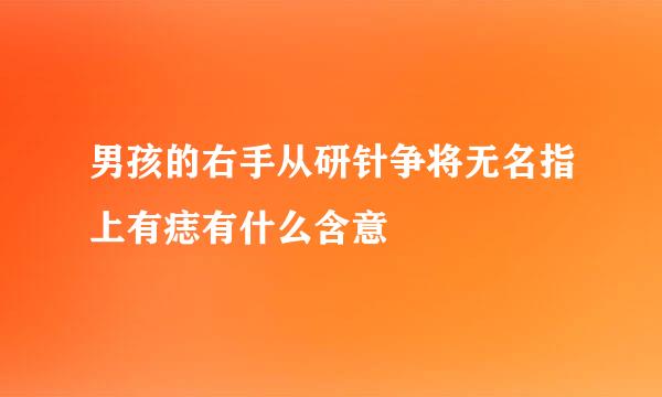 男孩的右手从研针争将无名指上有痣有什么含意