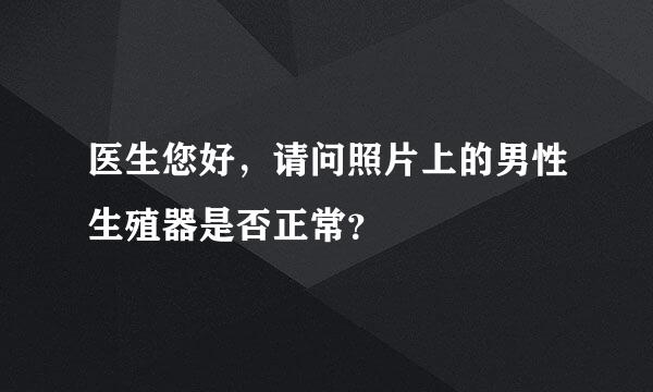 医生您好，请问照片上的男性生殖器是否正常？