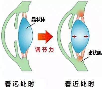 视力怎么恢复？