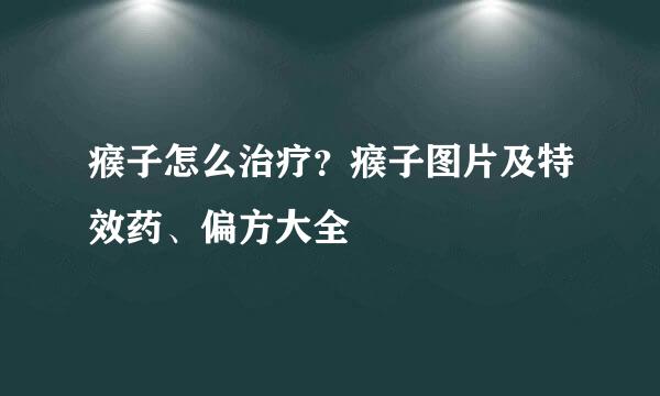 瘊子怎么治疗？瘊子图片及特效药、偏方大全