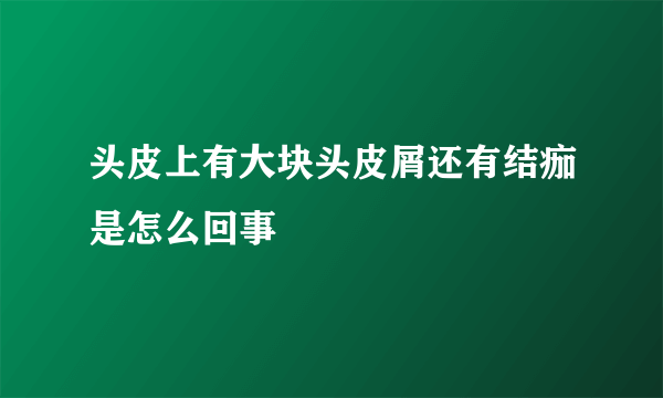 头皮上有大块头皮屑还有结痂是怎么回事