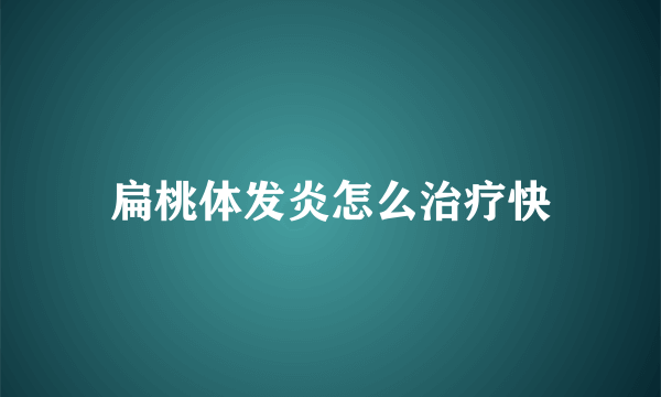 扁桃体发炎怎么治疗快