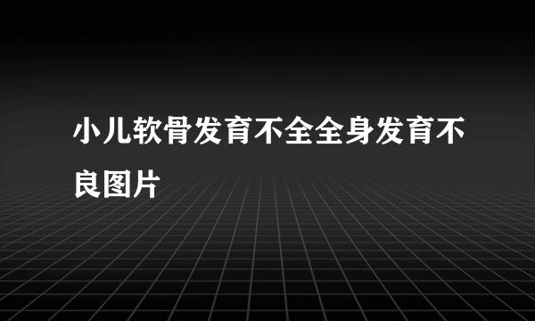 小儿软骨发育不全全身发育不良图片