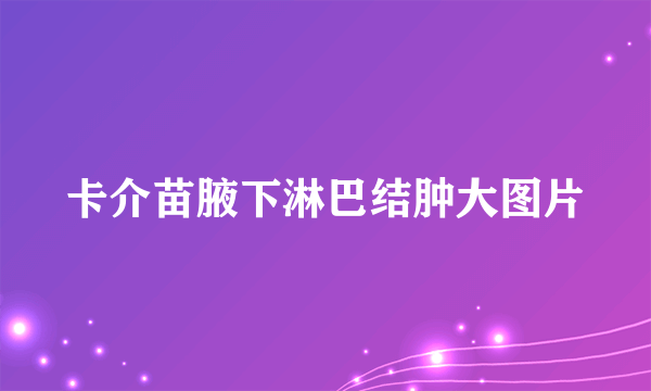 卡介苗腋下淋巴结肿大图片