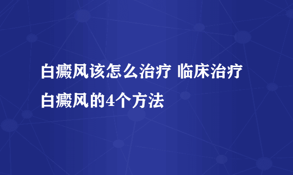 白癜风该怎么治疗 临床治疗白癜风的4个方法