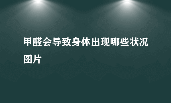 甲醛会导致身体出现哪些状况图片