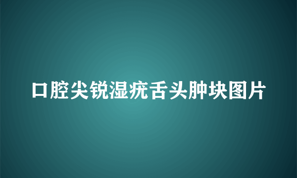 口腔尖锐湿疣舌头肿块图片