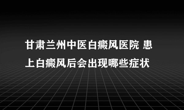 甘肃兰州中医白癜风医院 患上白癜风后会出现哪些症状