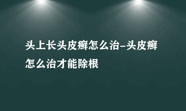 头上长头皮癣怎么治-头皮癣怎么治才能除根