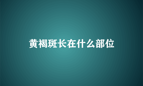 黄褐斑长在什么部位