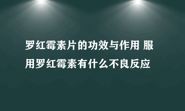 罗红霉素片的功效与作用 服用罗红霉素有什么不良反应