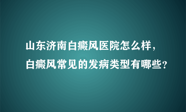 山东济南白癜风医院怎么样，白癜风常见的发病类型有哪些？