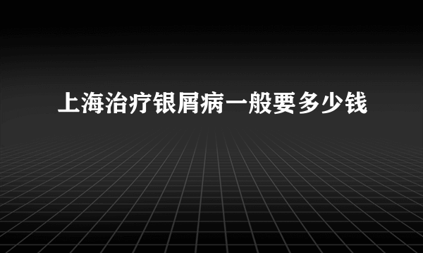 上海治疗银屑病一般要多少钱