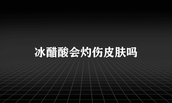 冰醋酸会灼伤皮肤吗