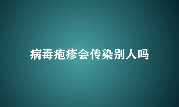 病毒疱疹会传染别人吗