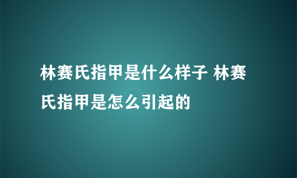 林赛氏指甲是什么样子 林赛氏指甲是怎么引起的