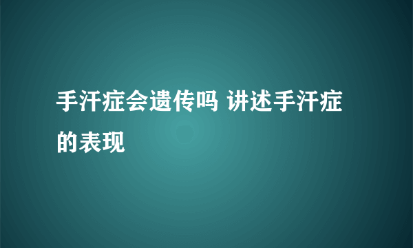 手汗症会遗传吗 讲述手汗症的表现