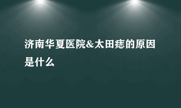 济南华夏医院&太田痣的原因是什么