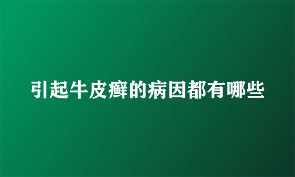 引起牛皮癣的病因都有哪些