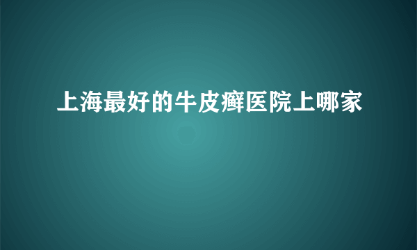 上海最好的牛皮癣医院上哪家