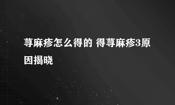 荨麻疹怎么得的 得荨麻疹3原因揭晓