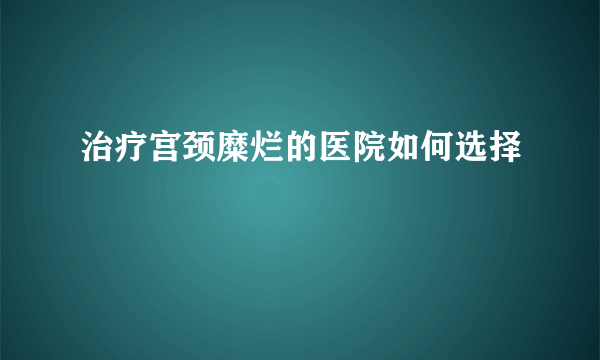 治疗宫颈糜烂的医院如何选择