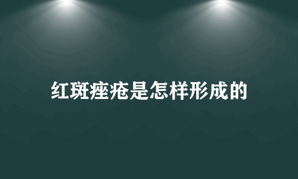 红斑痤疮是怎样形成的