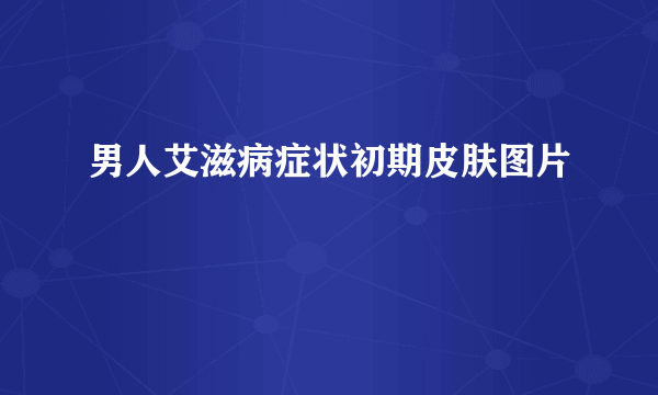 男人艾滋病症状初期皮肤图片