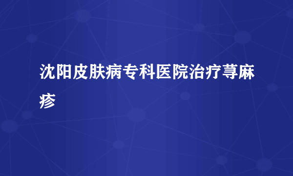 沈阳皮肤病专科医院治疗荨麻疹