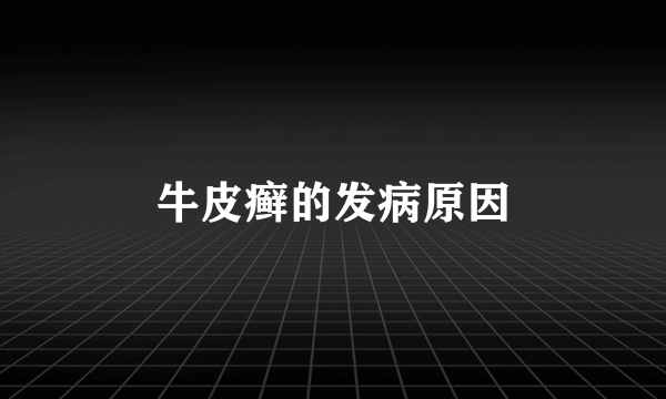 牛皮癣的发病原因