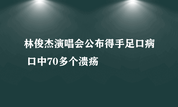 林俊杰演唱会公布得手足口病 口中70多个溃疡