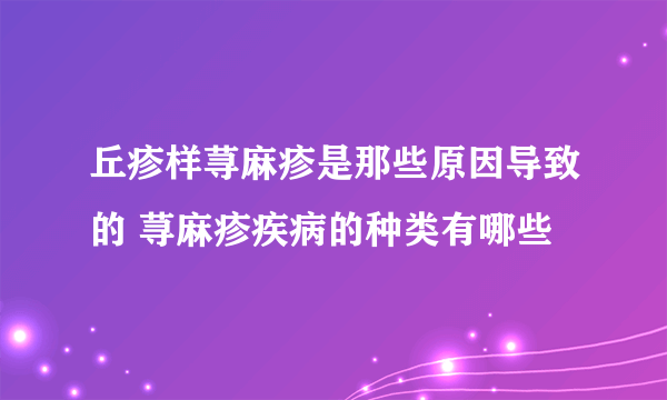 丘疹样荨麻疹是那些原因导致的 荨麻疹疾病的种类有哪些