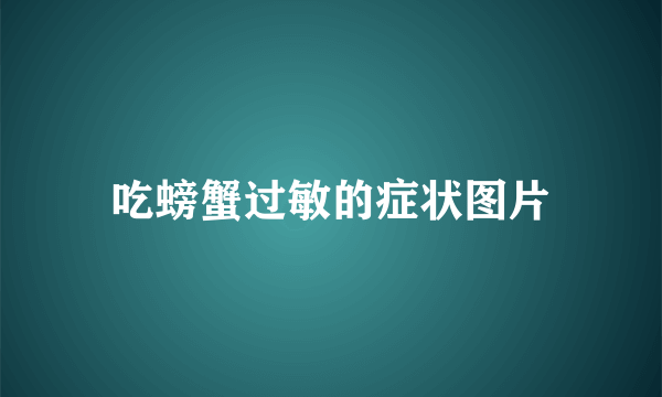 吃螃蟹过敏的症状图片