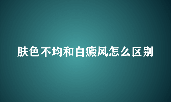 肤色不均和白癜风怎么区别