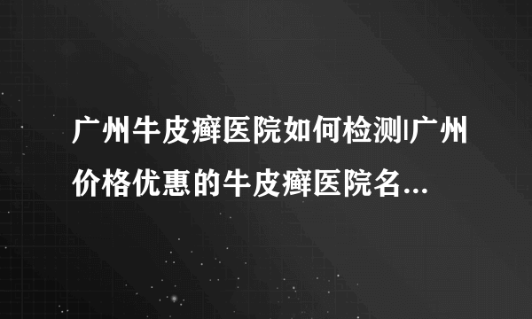 广州牛皮癣医院如何检测|广州价格优惠的牛皮癣医院名单公布-儿童牛皮癣的心理护理